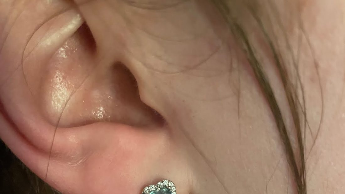 Look at what I got yesterday in my ear